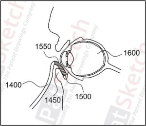 Biotechnological Patent Drawing Examples 1