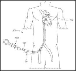 Medical Devices Patent Drawing Example 2